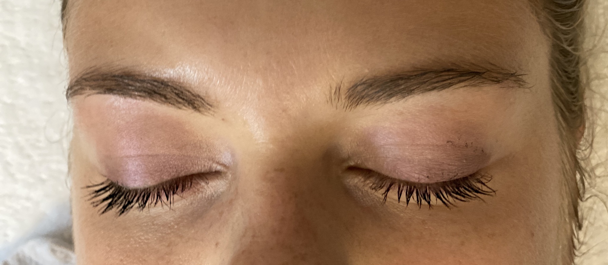 Browlifting - vor der Behandlung